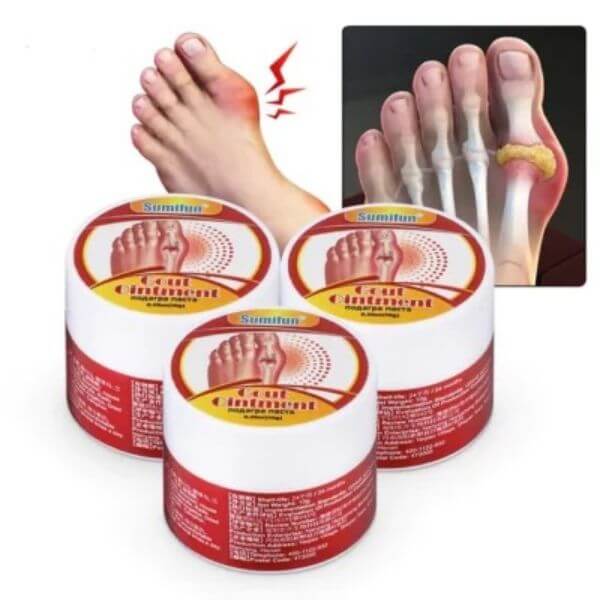GOUT HEALING OINTMENT