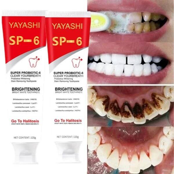 TOOTHPASTE ORAL HEALTH MANAGEMENT